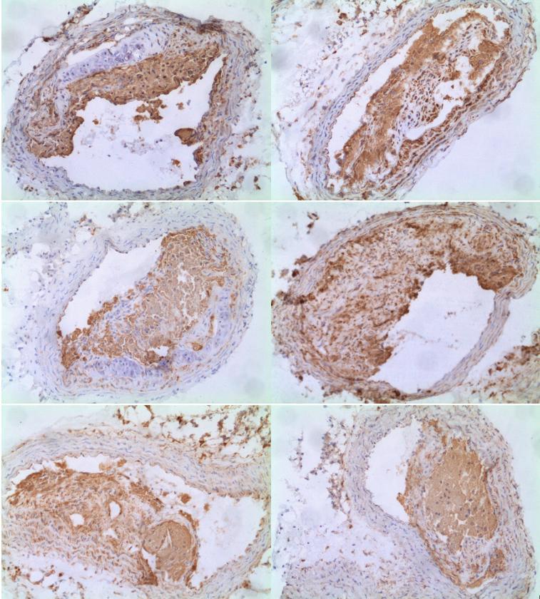 Obrázek 6: Reprezentativní obrázky imunohistochemického barvení makrofágů u kontrolní skupiny zvířat.