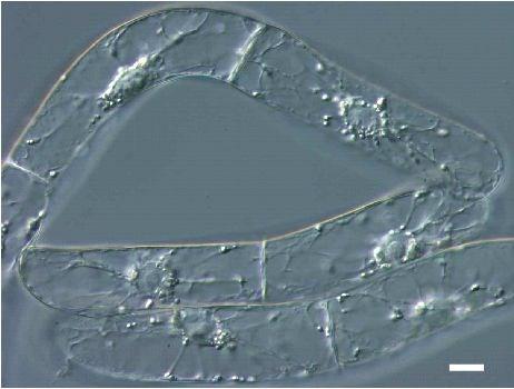 po vývoj plodů DR5rev::GFP + Auxin - Auxin Suspenzní kultura tabáku BY-2