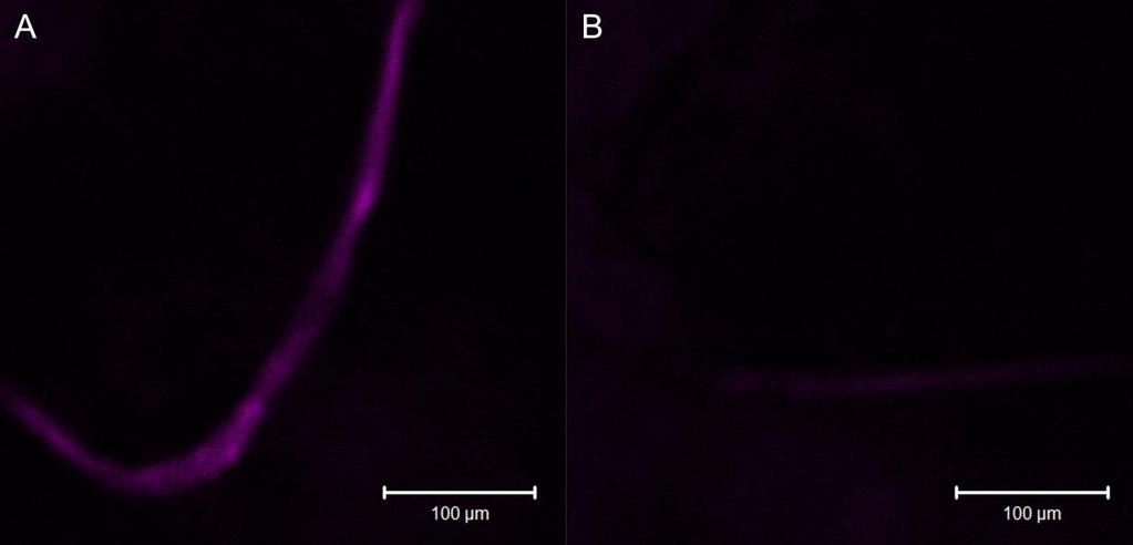 povrch vláken proteiny, využili jsme opět metody konfokální mikroskopie.