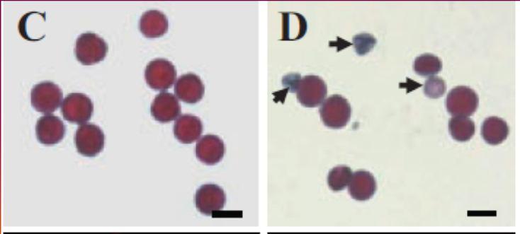 DEFECTIVE 1) kóduje F a d podjednotku mitochondriální F 1 F 0