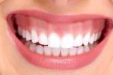 4 30 25 25 20 15 15 17 10 5 0 8 7 6 2 3 3 3 1 0 0 0 0 Vůbec nelíbí Nelíbí Dobré Líbí se mi Moc líbí Ekonomie Ortodoncie Dentální hygiena