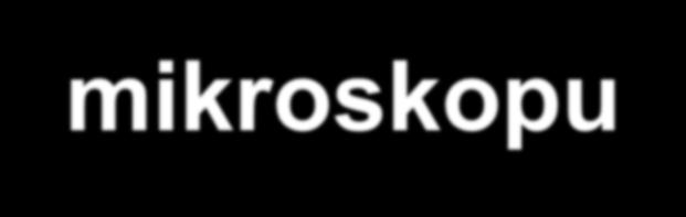 Rozlišovací schopnost světelného mikroskopu je shodná s rozlišovací schopností objektivu - je závislá na: - numerické apertuře (NA) objektivu a kondenzoru - na vlnové délce světla použitého k