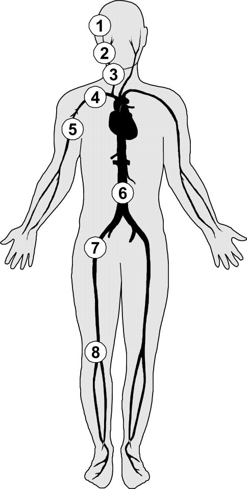 Stavění masivního krvácení: tlakové body (ERC 2015 nedoporučeny!!) 1. Spánkový a.temporalis 2. Lícní a.facialis 3. Krční a.