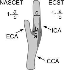 1) ECST: [1-(a/b)]x100 2) NASCET:[1-(a/c)]x100 NASCET a ECST lineární metody, které podhodnocují