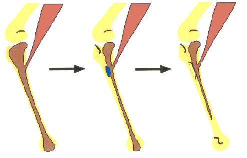 Důležitost mechanických stimulů a integrace epigenetických procesů do vývinu Origin of the fibular crest in