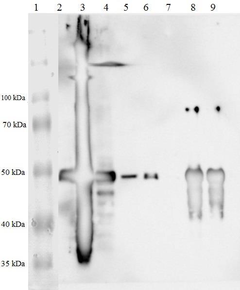 Obrázek 22: Izoforma p53β membrána po westernovém přenosu a aplikaci protilátek, start č. 1: Proteinový žebříček 10 260 kda; start č. 2 č.