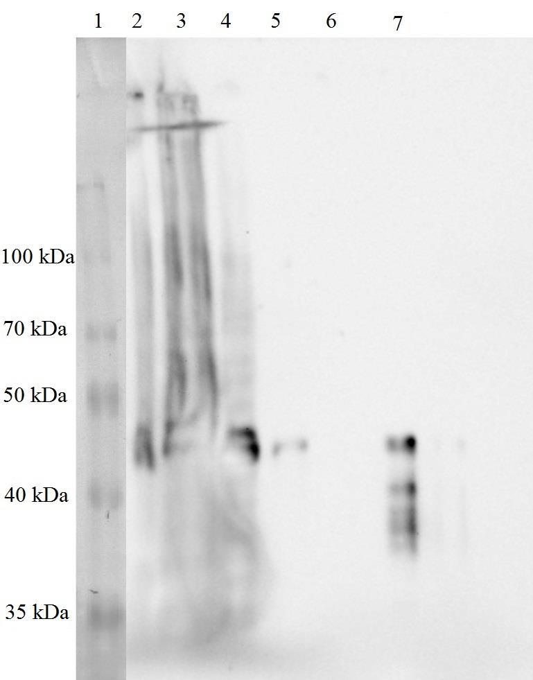 Obrázek 23: Izoforma Δ40p53α membrána po westernovém přenosu a aplikaci protilátek, start č. 1: Proteinový žebříček 10 260 kda; start č. 2 č.