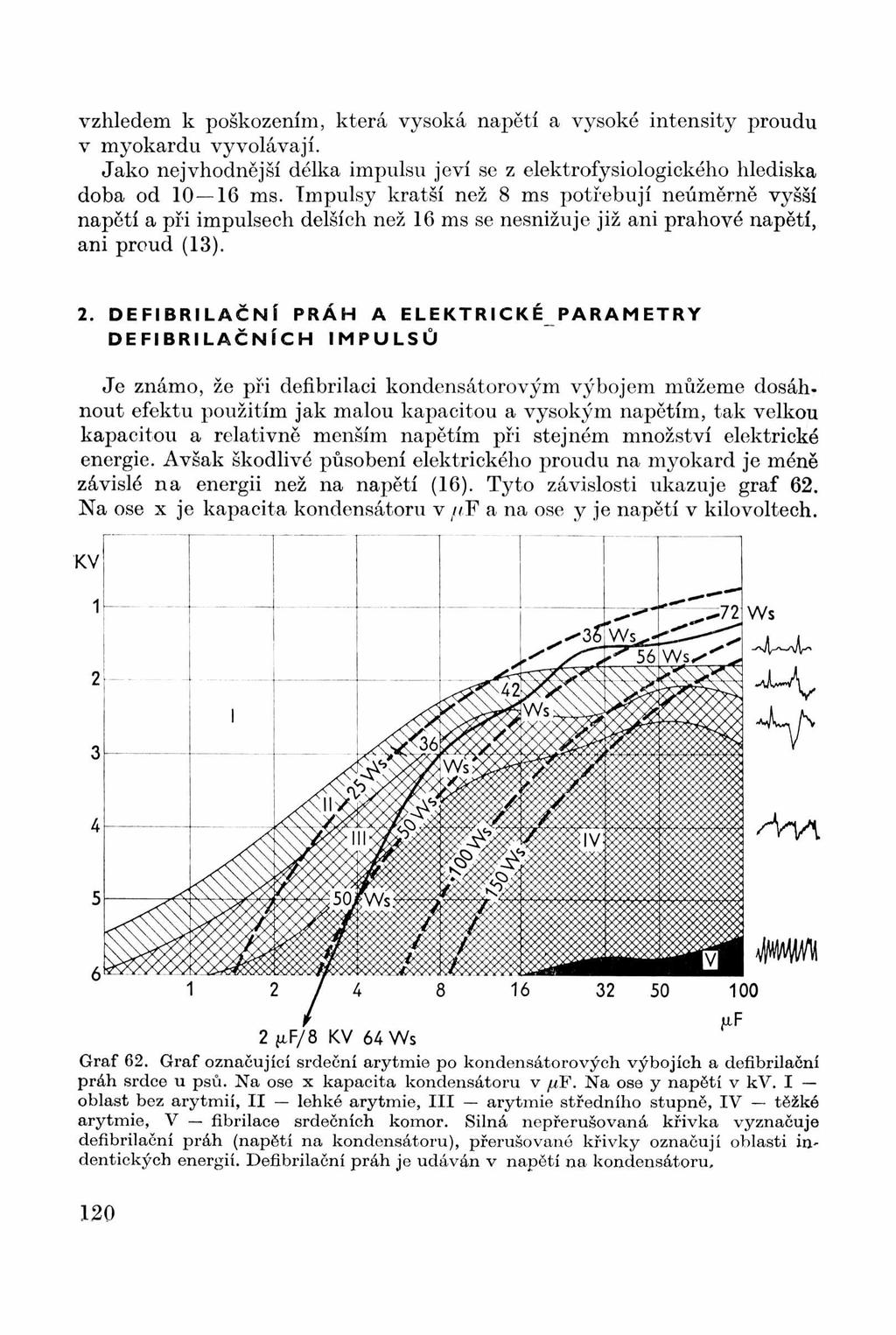 vzhledem k poškozením, která vysoká napětí a vysoké intensity proudu v myokardu vyvolávají. Jako nejvhodnější délka impulsu jeví se z elektrofysiologického hlediska doba od 10 16 ms.