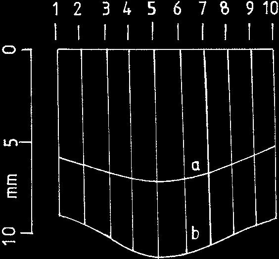 Obr. 11 PrÛhyby mostu v âesk ch Budûjovicích Fig. 11 Deflection of the bridge in âeské Budûjovice je její tuhost.