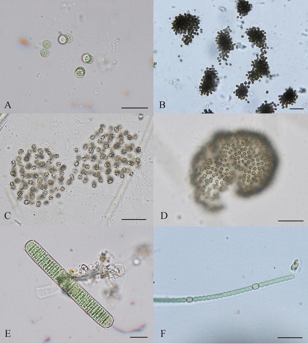 Příloha 5: Fotogalerie vybraných druhů Cyanophyceae (A Chroococcus cf limneticus, B Microcystis flosaquae (WITTROCK) KIRCHNER, C Microcystis