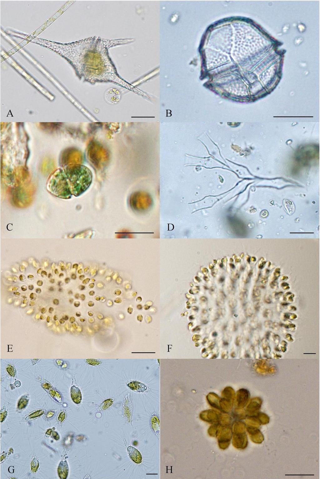 Příloha 7: Fotogalerie vybraných druhů Dinophyceae, Chrysophyceae a Synurophyceae (A Ceratium hirundinella (MÜLLER) DUJARDIN, B prázdná schránka Peridinium bipes STEIN, C