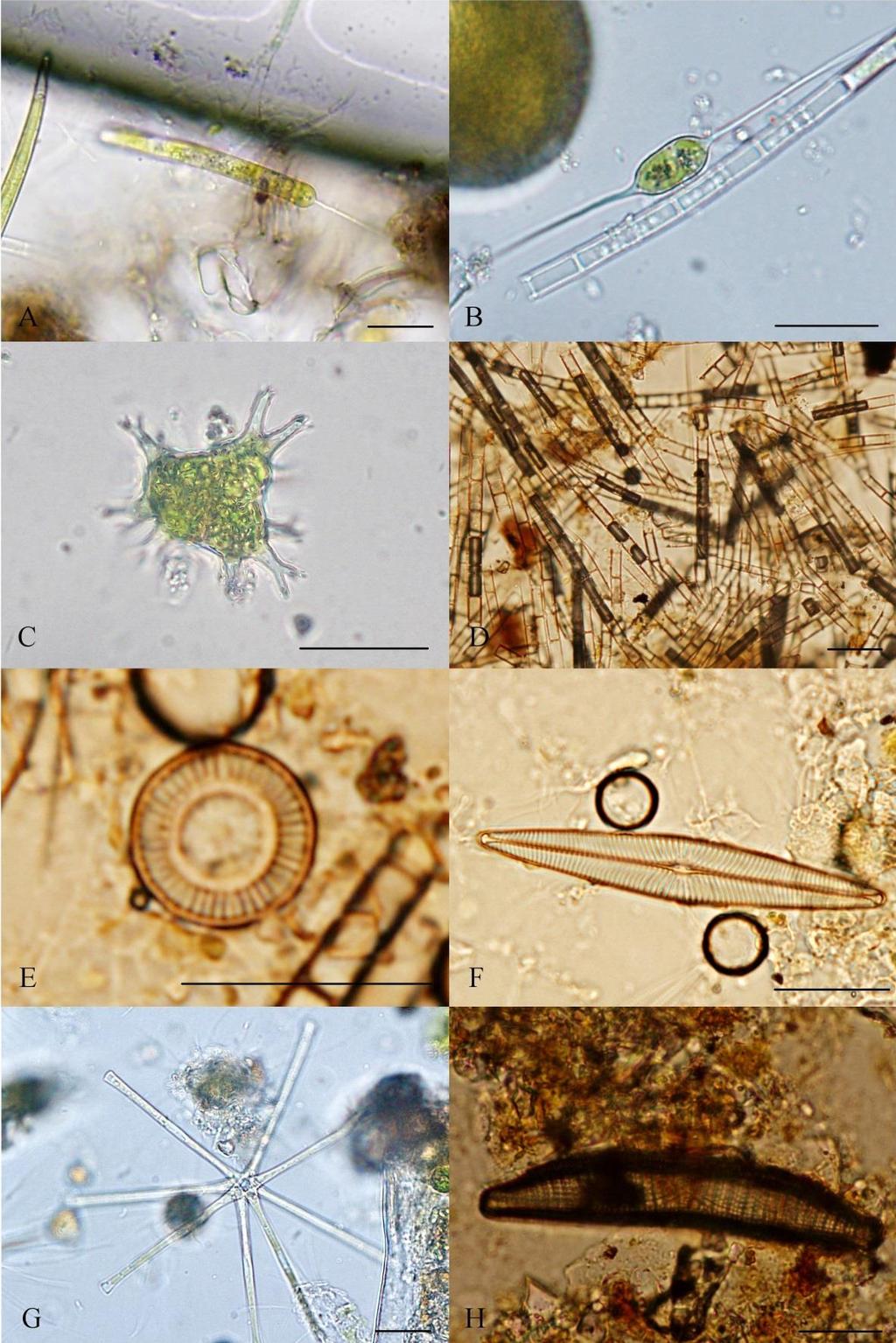 Příloha 8: Fotogalerie vybraných druhů anthophyceae, Eustigmatophyceae a Bacillariophyceae (A Centritractus cf. belophorus, B Centritractus sp., C Pseudostaurastrum cf.