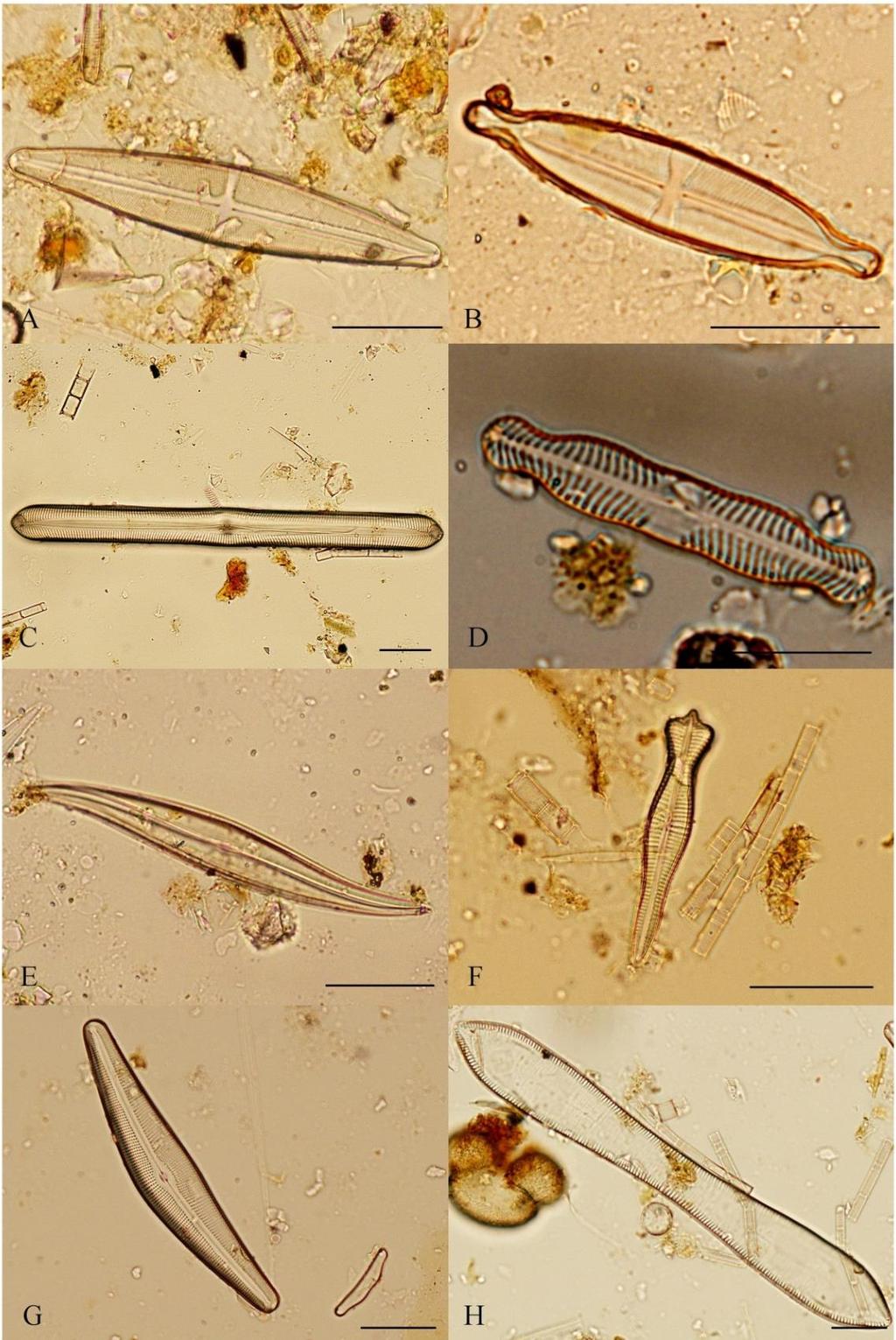 Příloha 9: Fotogalerie vybraných druhů Bacillariophyceae (A Stauroneis phoenicenteron (NITZSCH) EHRENBERG, B Stauroneis anceps EHRENBERG, C Pinnularia transversa (SCHMIDT), MAYER, D Pinnularia