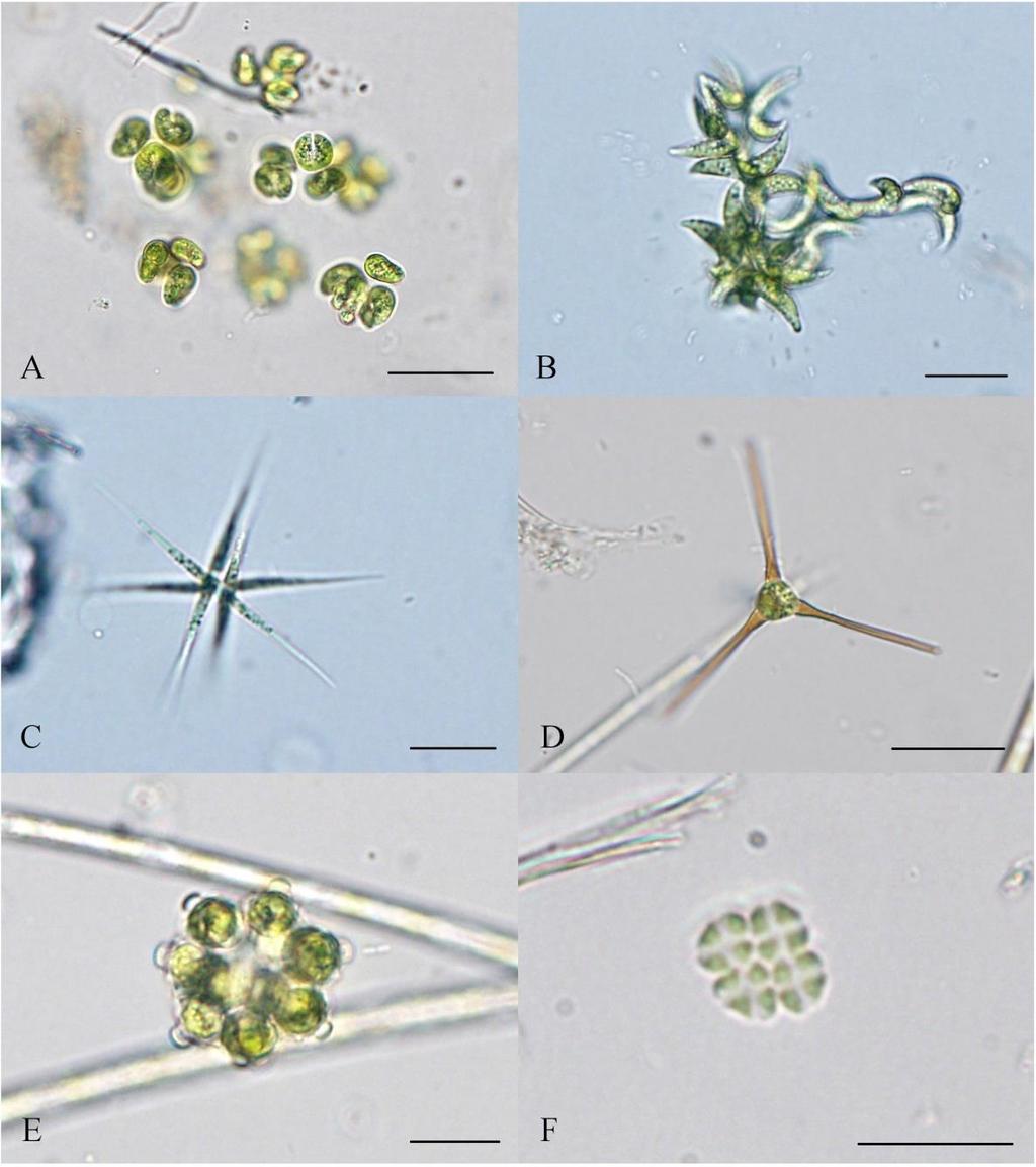 Příloha 11: Fotogalerie vybraných druhů Chlorophyceae (A Kirchneriella obesa (WEST) WEST, B Selenastrum capricornutum PRINTZ, C Ankistrodesmus