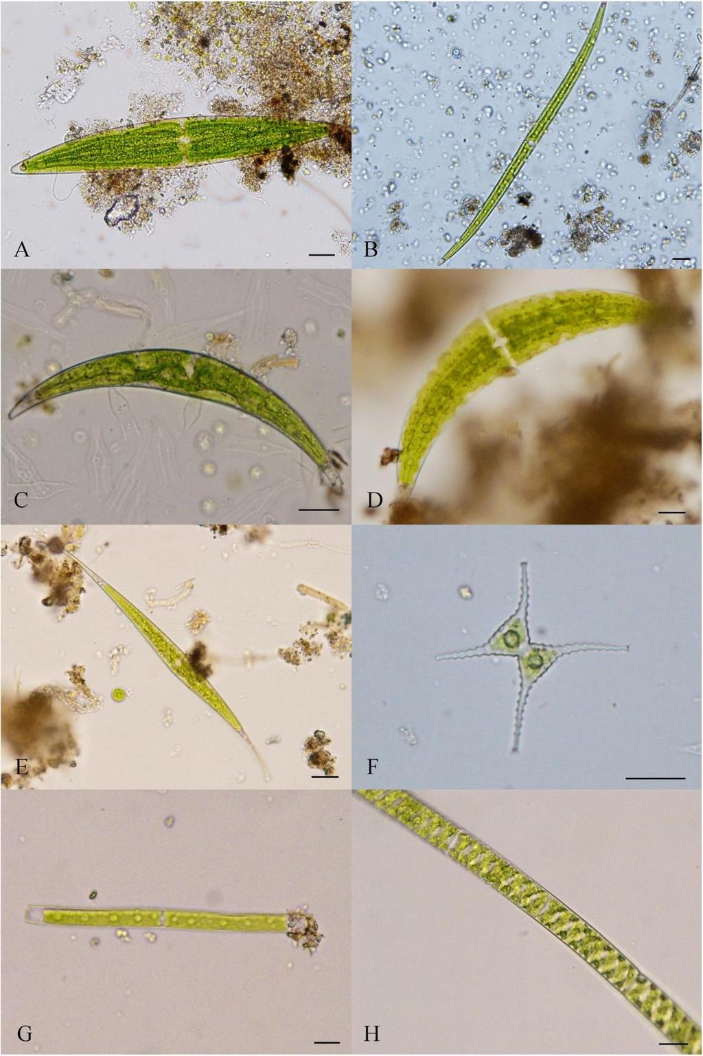 Příloha 12: Fotogalerie vybraných druhů Zygnematophyceae (A Closterium cf. lunula RALFS, B Closterium lineatum RALFS., C Closterium sp. 1, D - Closterium sp.