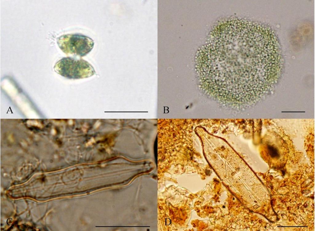 Příloha 13: Fotogalerie obtížně určitelných druhů (A Staurodesmus sp.