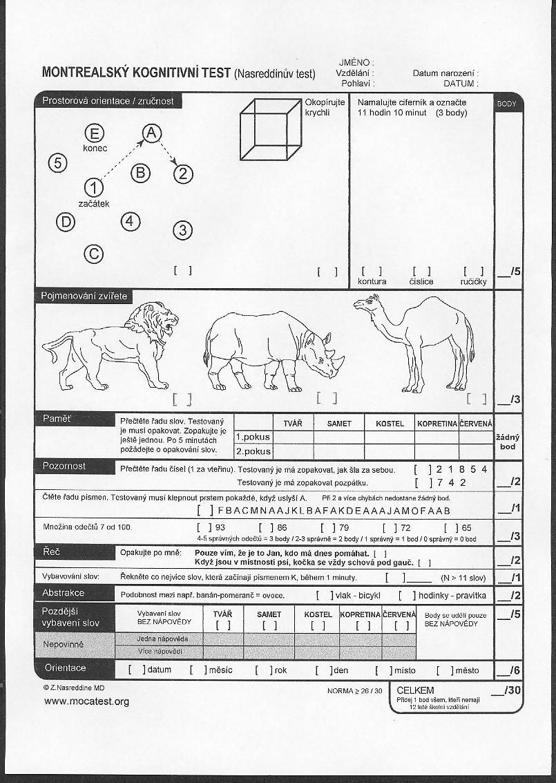 MoCA test - senzitivní Senzitivita 90%, sepcificita 90%