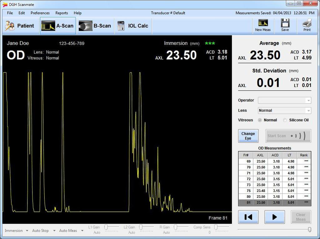 15 Okno A-Skenu (A-Scan Screen) Okno A-Skenu umožňuje uživatelům provádět a prohlížet měření A-Skenů u aktuálně zvoleného pacienta.