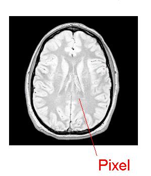 Úvod Základy Fyzika MRI Historie