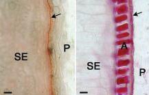 23 Mutant defective kernel 1 (dek1) nevytváří aleuronovou vrstvu, místo ní vytváří škrobové buňky; gen DEK1