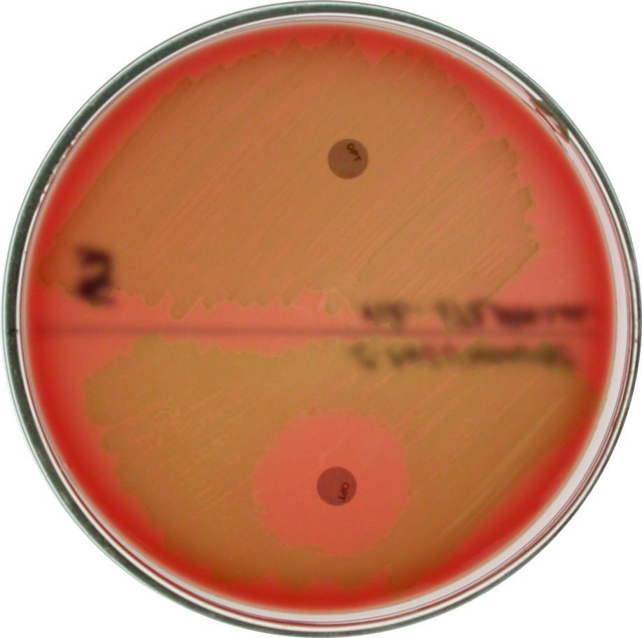 5 % CO 2 ) Streptococcus