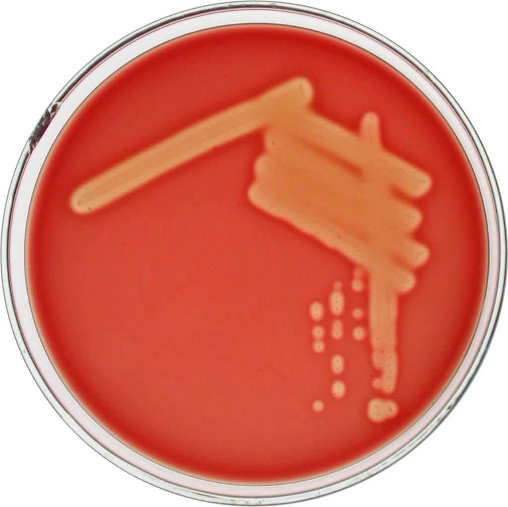 KULTIVACE Streptococcus