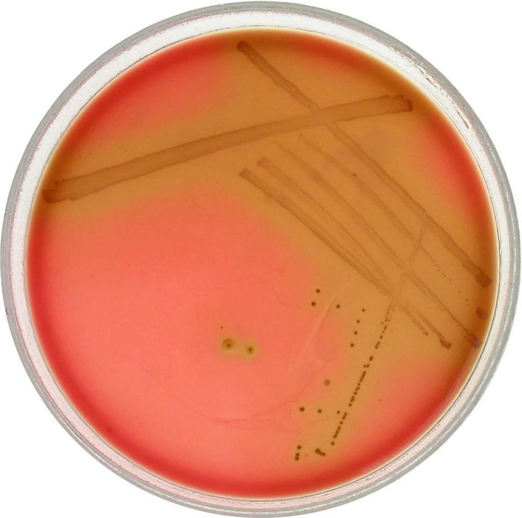 Enterococcus faecalis