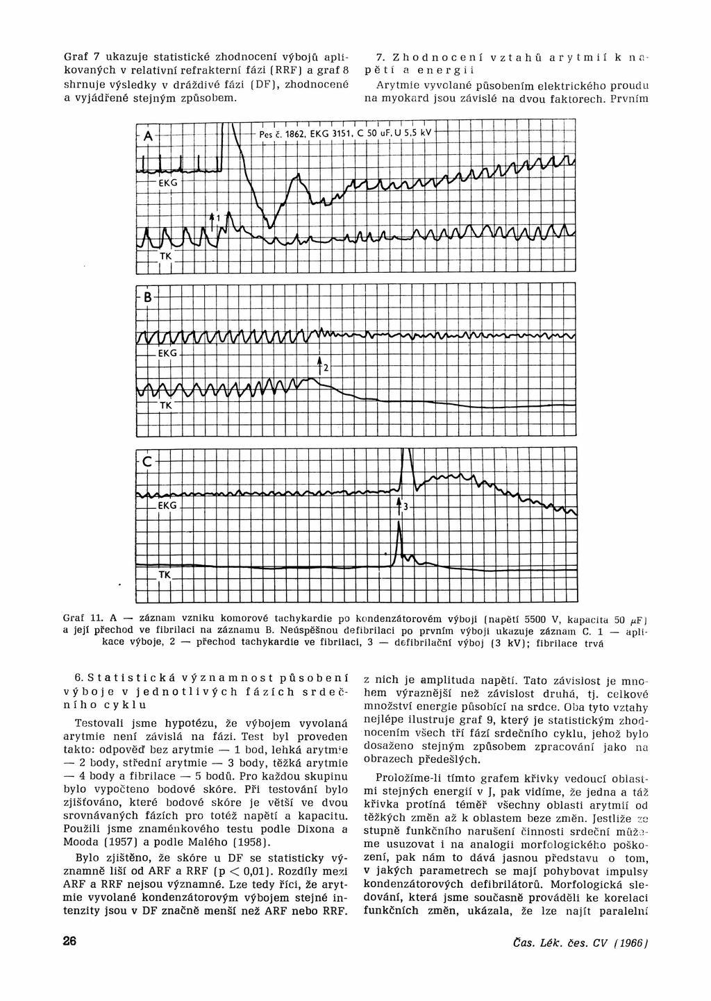 Graf 7 ukazuje statistické zhodnocení výbojů aplikovaných v relativní refrakterní fázi [RRF] a graf 8 shrnuje výsledky v dráždivě fázi (DF), zhodnocené a vyjádřené stejným způsobem. 7. Zhodnocení vztahů arytmií k napětí a energii Arytmie vyvolané působením elektrického proudu na myokard jsou závislé na dvou faktorech.