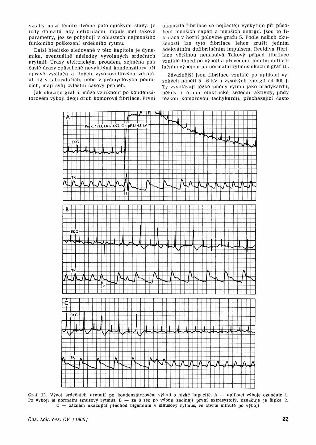 vztahy mezi těmito dvěma patologickými stavy, je tedy důležité, aby defibrilační impuls měl takové parametry, jež se pohybují v oblastech nejmenšího funkčního poškození srdečního rytmu.