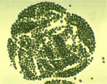 Peptidické hepatotoxiny sinic Microcystiny