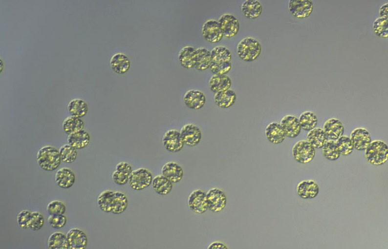 Microcystis