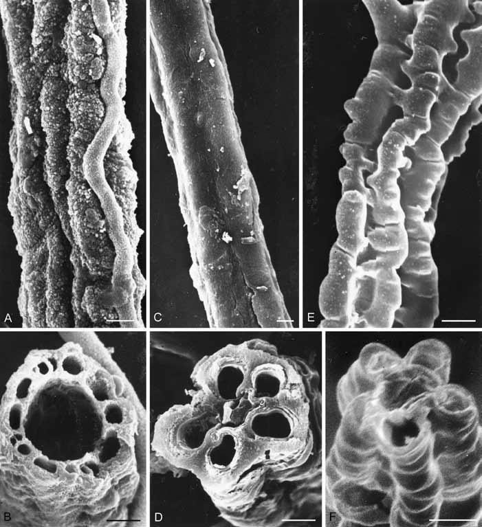 doplňkové typy stélek - vláknitá Fig. 3. SEM micrographs of filaments.