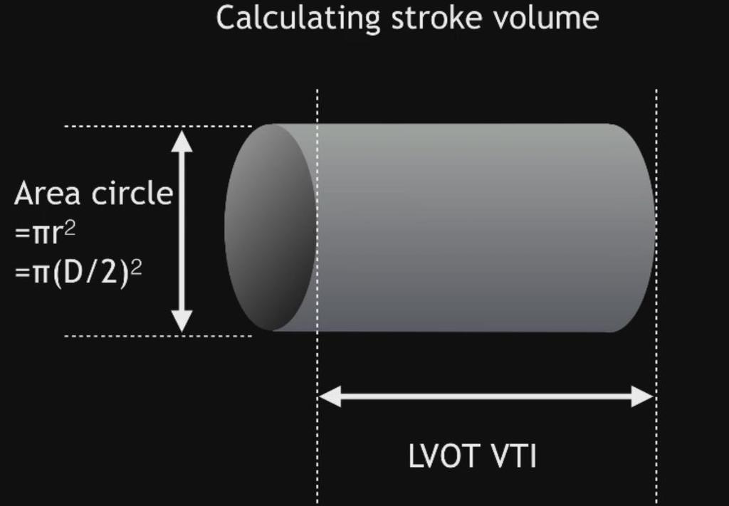 Měření CO CO = SV x TF SV = CSA LVOT x průtok