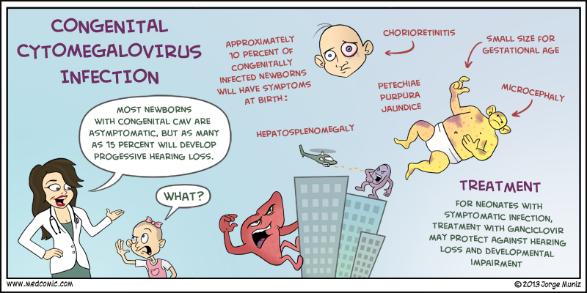 CMV (Cytomegalovirus), HHV-5 Mění buňky zvětšují se Primární infekce: inaparentní, výjimečně jako inf. mononukleóza slinné žlázy, ledv. kanálky po aktivaci inaparentní infekce.