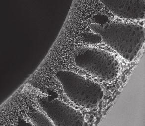Princip umělé ledviny Stěžeň 2/2012 prstová vnější vrstva (40 µm) houbovitá střední