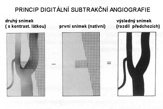 Mammografie Specielní jednoúčelový rentgen na vyšetření měkké tkáně.