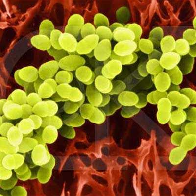 UTB in Zlín, Faculty of Technology 37 Figure 6 Staphylococcus aureus [46] 4.1.2 Bacillus subtilis Bacillus subtilis is a gram-positive, catalase-positive bacterium commonly found in soil.