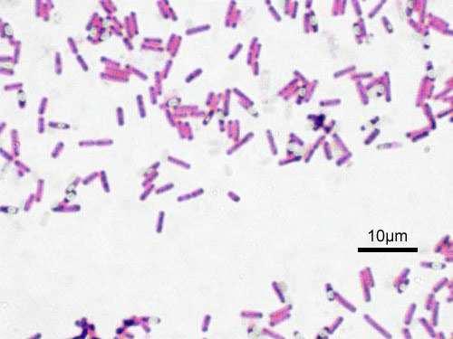 UTB in Zlín, Faculty of Technology 38 Figure 7 Gram-stained Bacillus subtilis [48] 4.1.