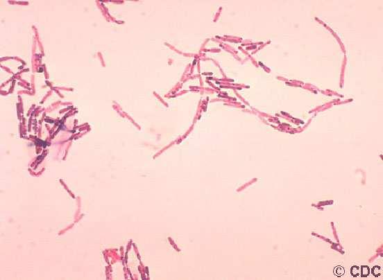 UTB in Zlín, Faculty of Technology 39 Figure 8 Bacillus cereus [51]