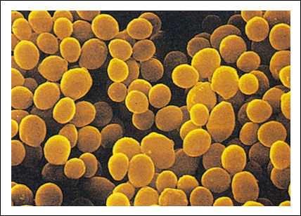 UTB in Zlín, Faculty of Technology 41 Figure 11 Micrococcus luteus [57] 4.1.7 Escherichia coli Escherichia coli are bacteria that are commonly found in the lower intestine of warmblooded animals.