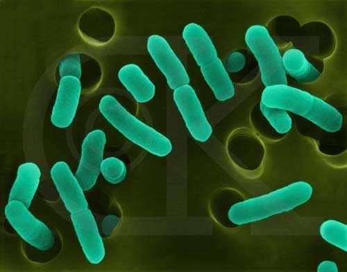 UTB in Zlín, Faculty of Technology 42 Figure 12 Escherichia coli