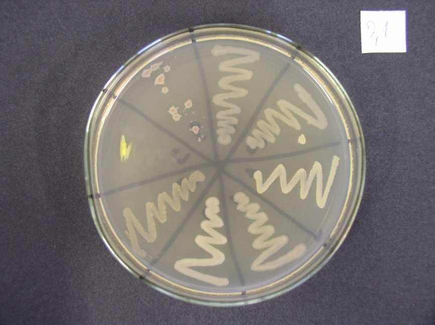 Appendix 1 Evaluation effect of emulsifying salt JOHA HBS for chosen microorganisms Fig. 1 Control Petri dish Fig.