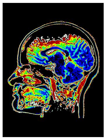 MRI-Magnetic