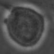 Profáze ( smrštění buňky z interfáze ) replikované chromosomy pocházející ze dvou sesterských chromatid,
