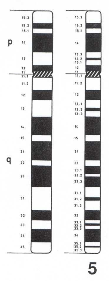 del (5p) syndrom Cri du