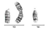 strukturní přestavby neobvyklé typy chromosomů dicentrické chromosomy (robertsonovská translokace) - na dvou chromosomech dojde ke zlomu - vznikne dicentrický chromosom fúzí úseků s