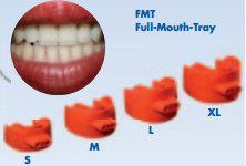 velikost 0 indikovaná na u dočasných zubů u dětí, M - velikost lžíce 1 indikovaná na mladé a