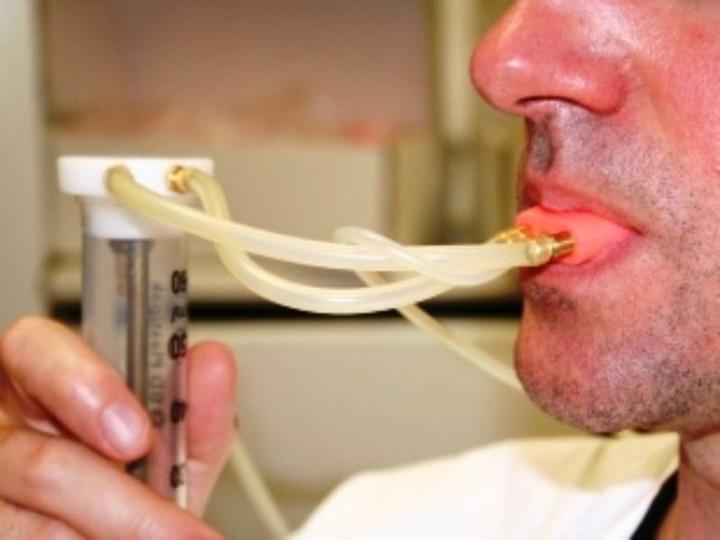 Obrázek 22 Silikonová lžíce v ústech pacienta, ozonová terapie pomocí