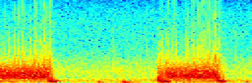 Frequency Mitrální regurgitace.5 -.5-1.2.4.6.8 1 1.2 1.