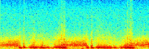 Frequency Mitrální regurgitace + mitrální stenóza.5 -.5-1.2.4.6.8 1 1.2 1.4 1.6 1.